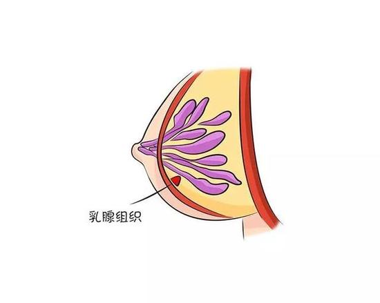 乳腺腺体组织图片