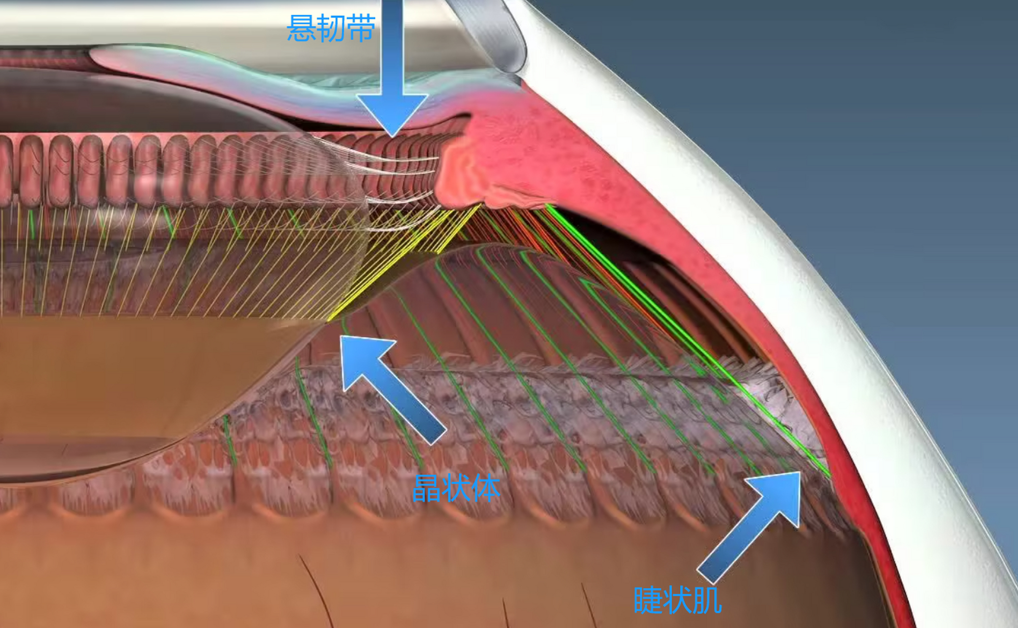 角膜定型后只能通过手术或物理压迫改善,晶状体和眼轴是防控重点.