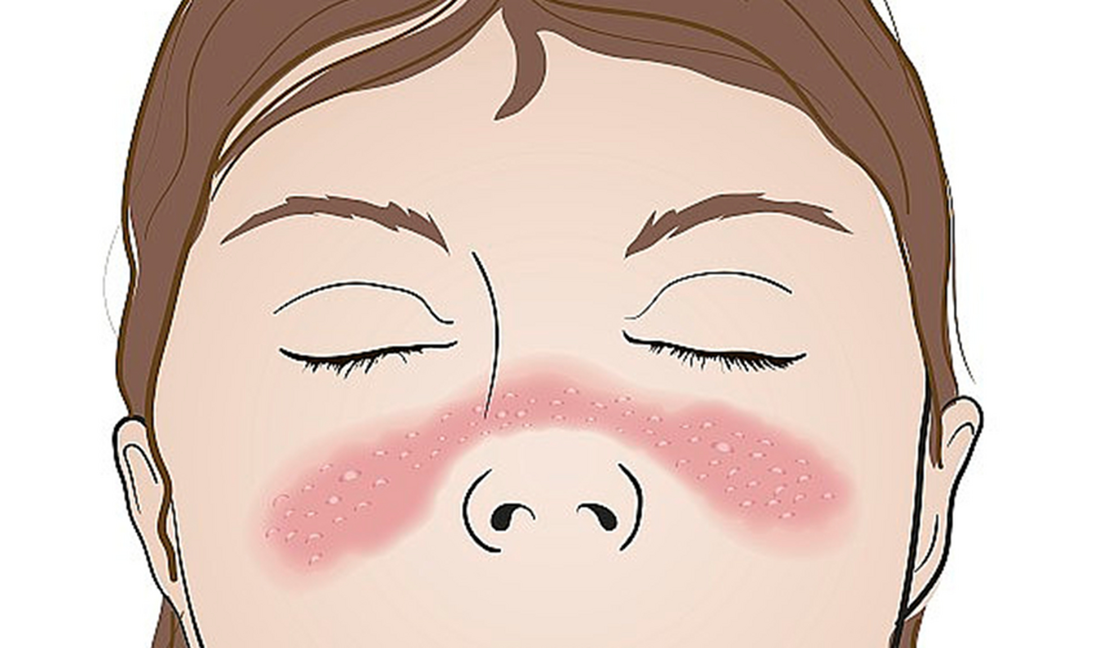 毛孔收缩与类型及原因有关.