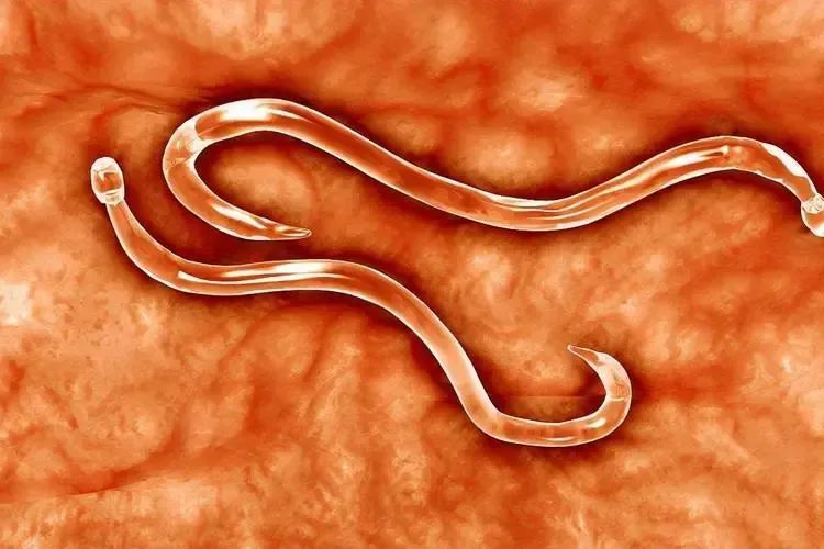 孩子手术中拽出5米活虫引发社会关注,食品安全对孩子健康至关重要