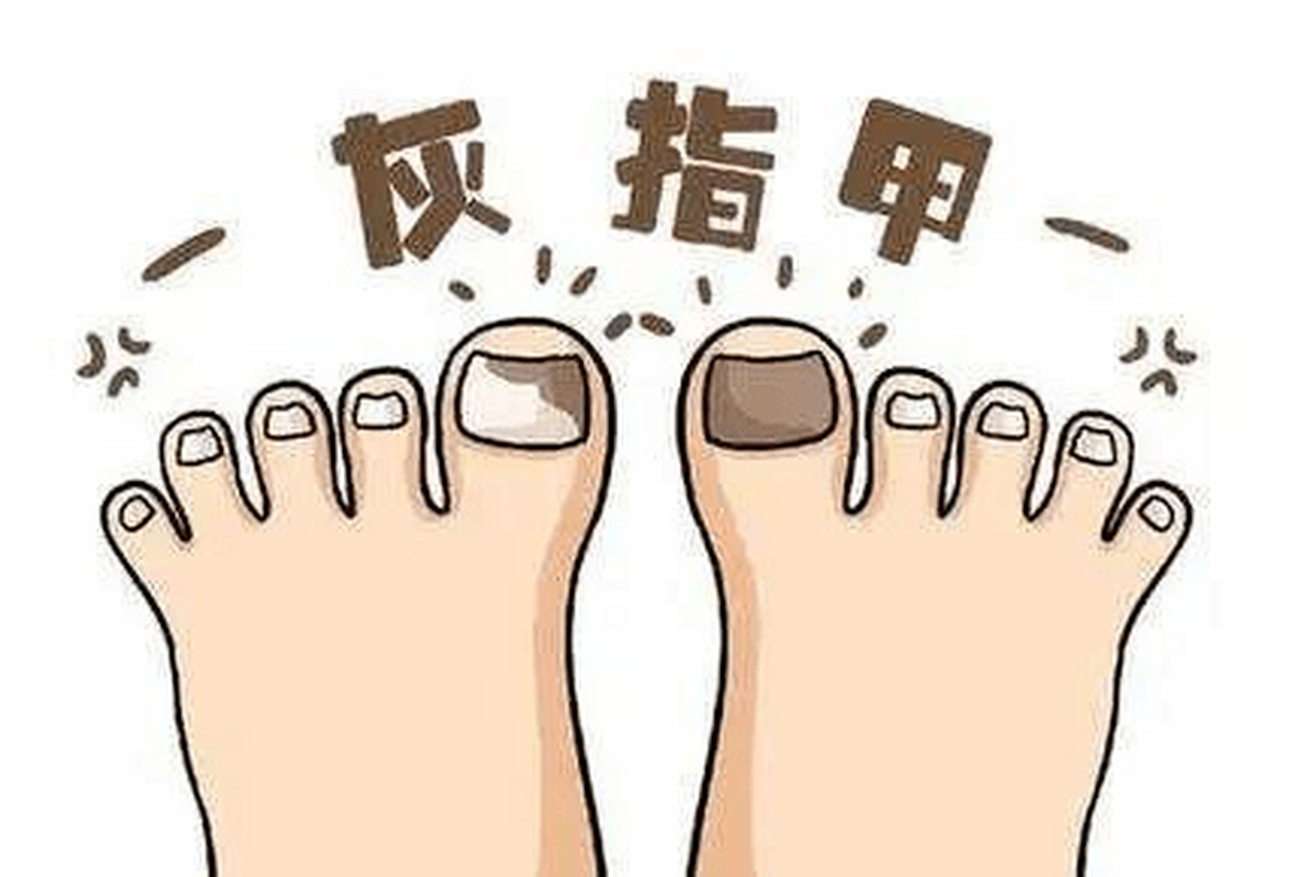 南京皮肤科预约# #南京皮肤病研究所#   95灰指甲的表现有很多