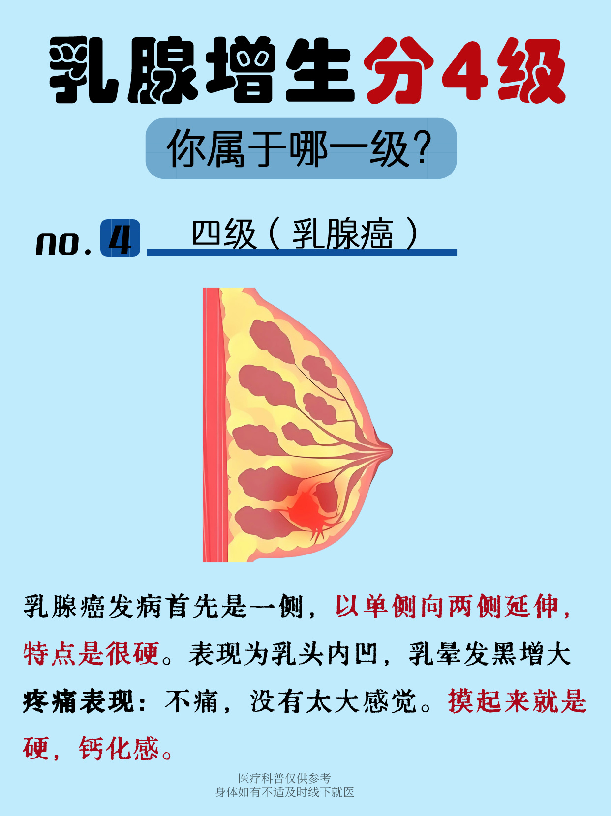 1,乳腺小叶增生 2,乳腺结节 3,乳腺囊肿 4,乳腺癌 #乳腺增生# #乳腺