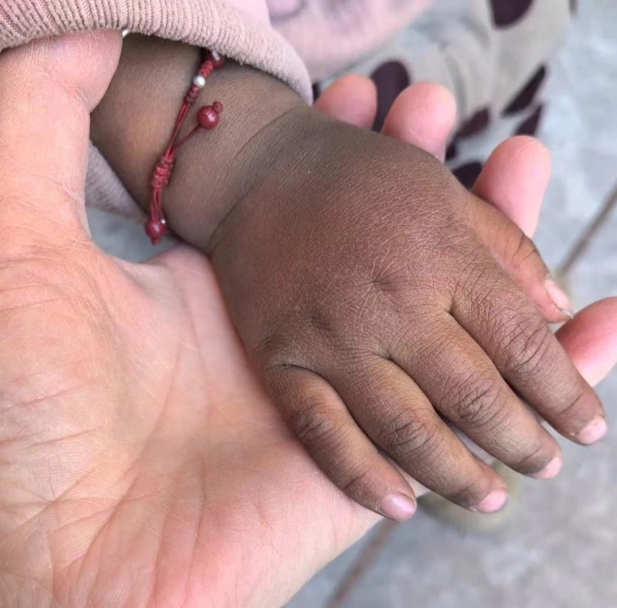 刚吃下去手突然就黑了,他在求救 大家帮帮他,有知道的告告他吧,谢谢了