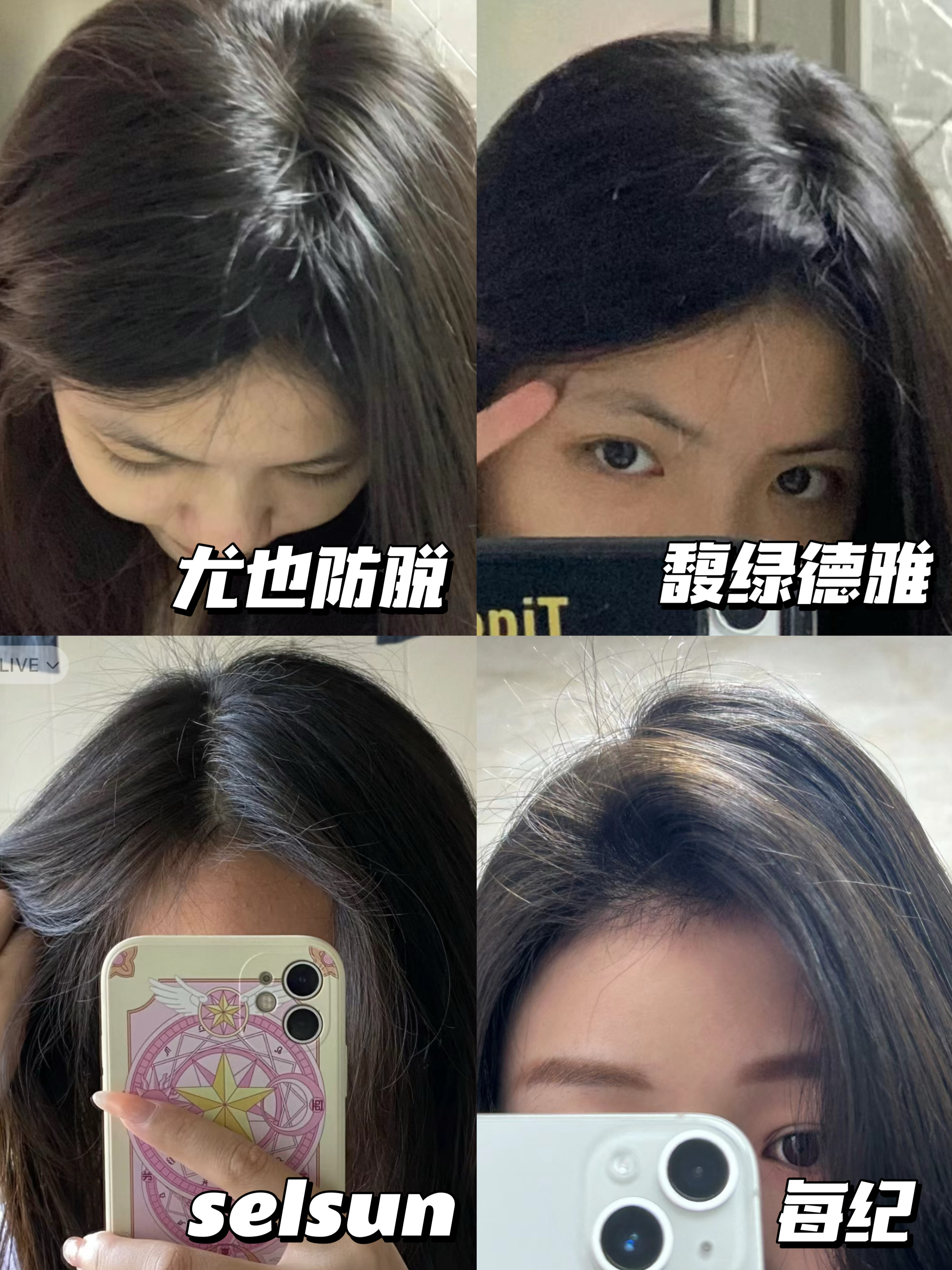 但是出门不是发缝大就是马尾细 年轻人的现状脱发是很常见的但是有