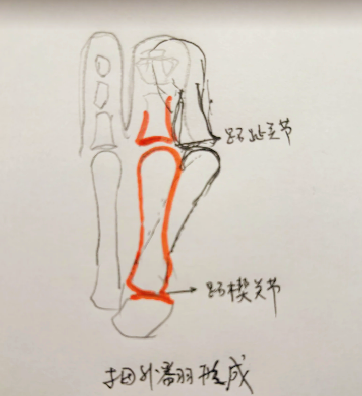 拇外翻角度测量方法图片