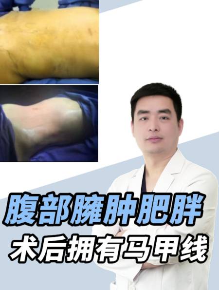 太绝了小肚腩爆改马甲线终于可以穿泳衣和露脐装了