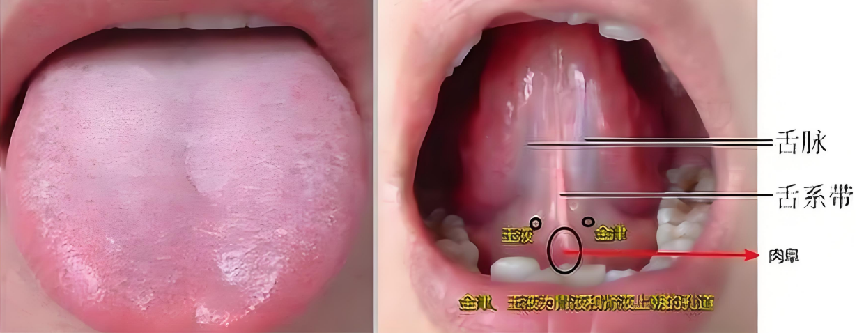 舌脉正常图片大全图片