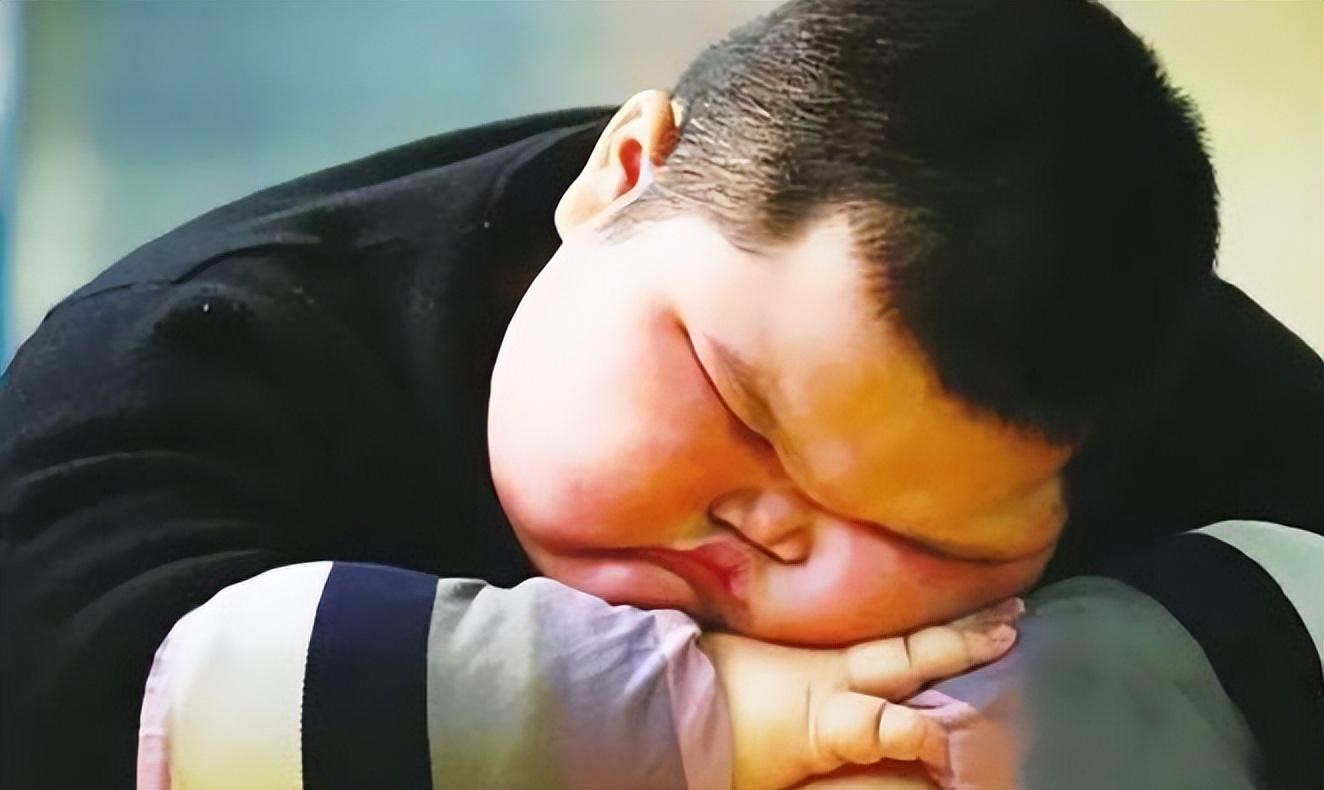 小胖威利综合征因为患上了"小胖威利综合征",年仅21岁的徐周磊就失去