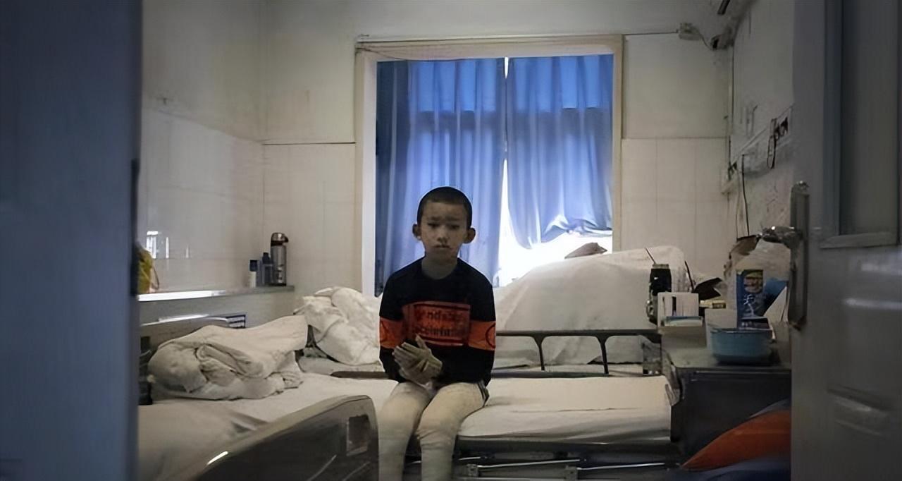 18年河南大火16岁姐姐全身90烧伤毁容弟弟的举动让人泪目