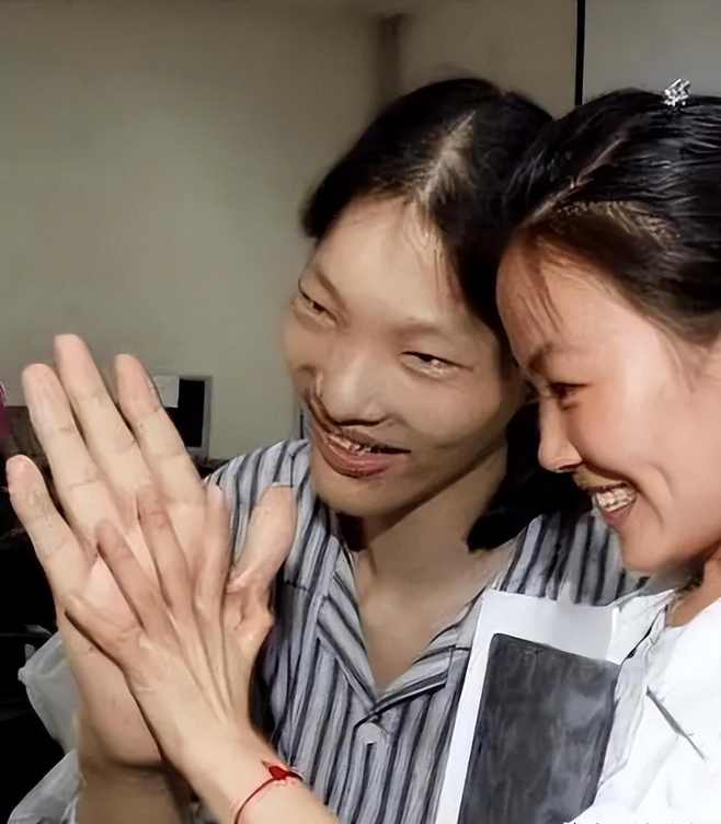 回顾女巨人来自中国安徽穿78码鞋子一顿吃6碗炒面