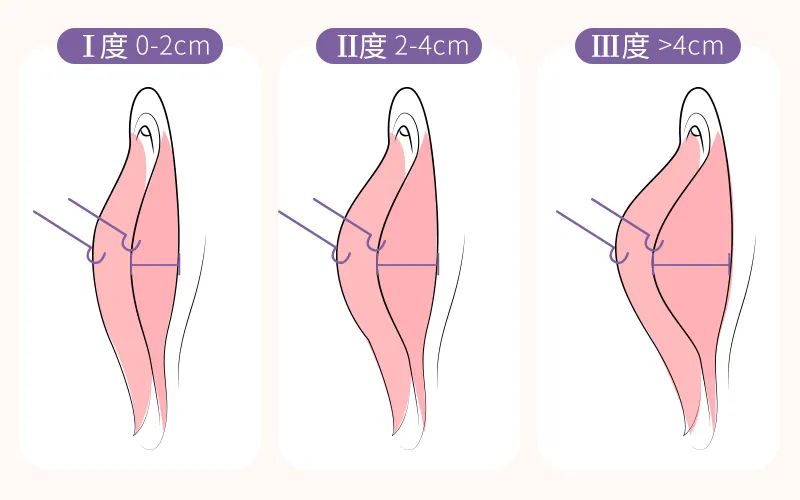 那些羞羞的小阴唇秘密大公开啦