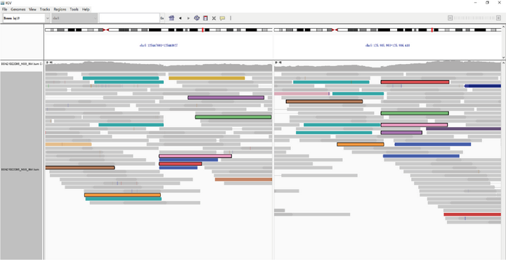 案例2:吡哆醇依赖性癫痫,基因检测仅发现单杂合时怎么办?