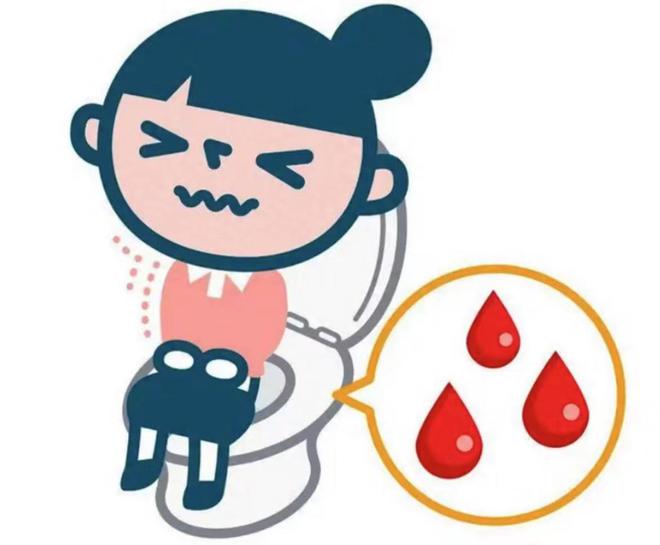 有简单方法能迅速消除痔疮?分享一招在家就能操作的治愈方法!