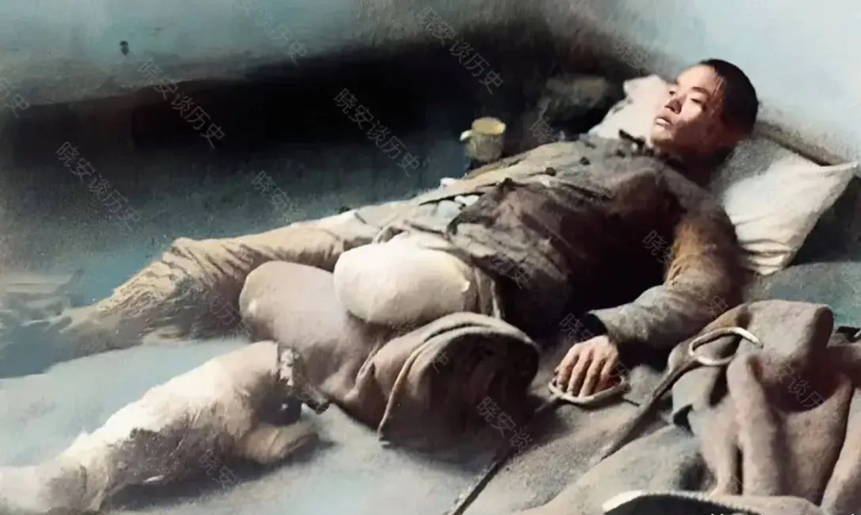 这张照片拍摄于1938年3月,台儿庄作战中,不幸失去左腿的中国军人