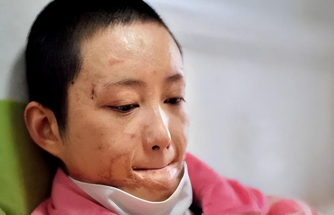 周岩之后就被救护车拉到了医院,在重症监护室躺了好几天才脱离危险.