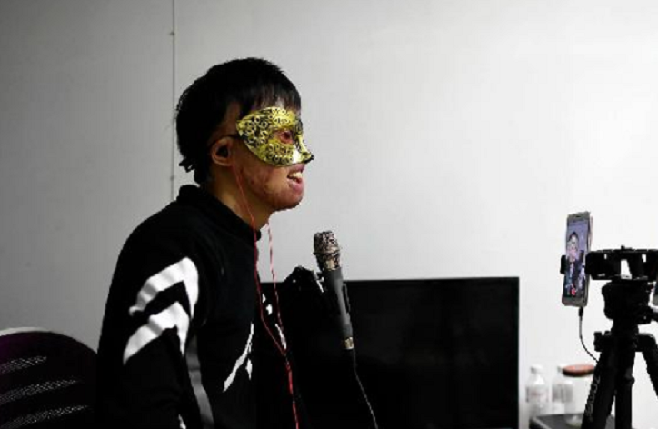 回顾重庆唐辉车祸中毁容并失双臂婚礼上亲口为妻子戴戒指