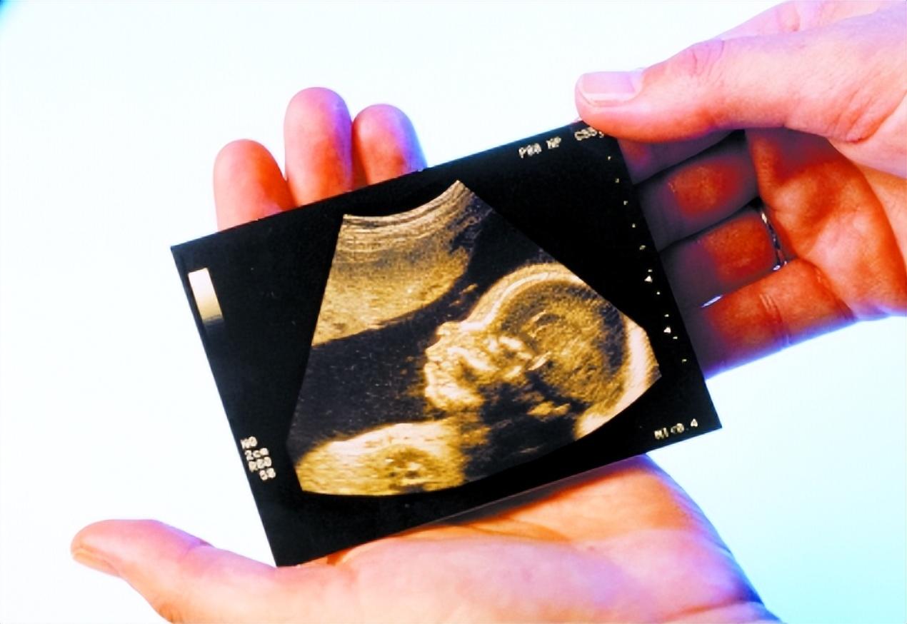 回顾河北35岁孕妇冒险生下5胞胎孩子已长大如今怎样了