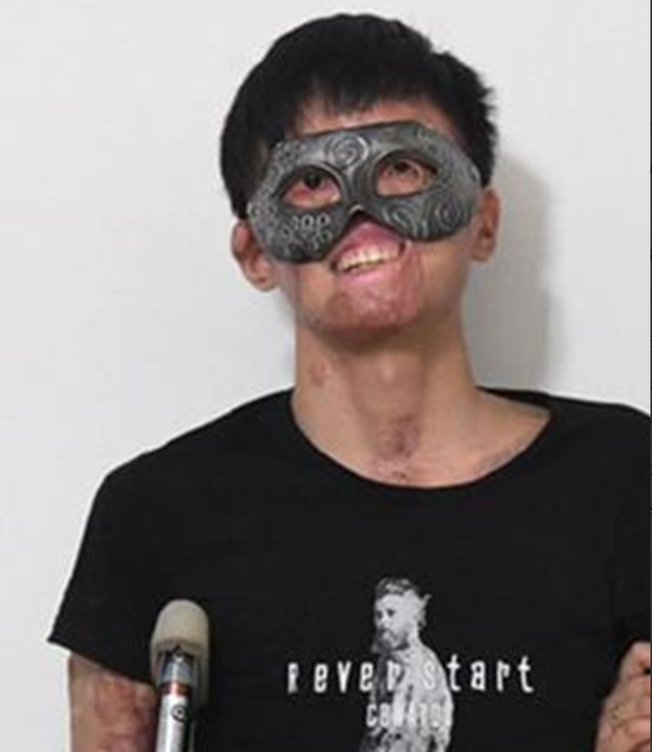 回顾重庆唐辉车祸中毁容并失双臂婚礼上亲口为妻子戴戒指