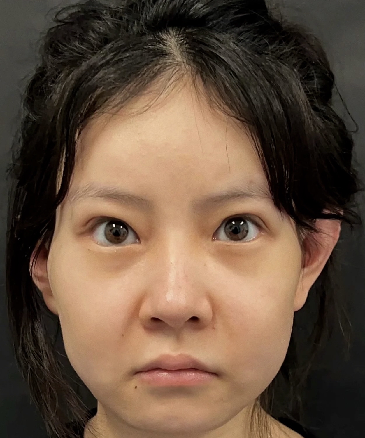 今年找大白补了卧蚕和眼下大家帮我看看翻车了吗?