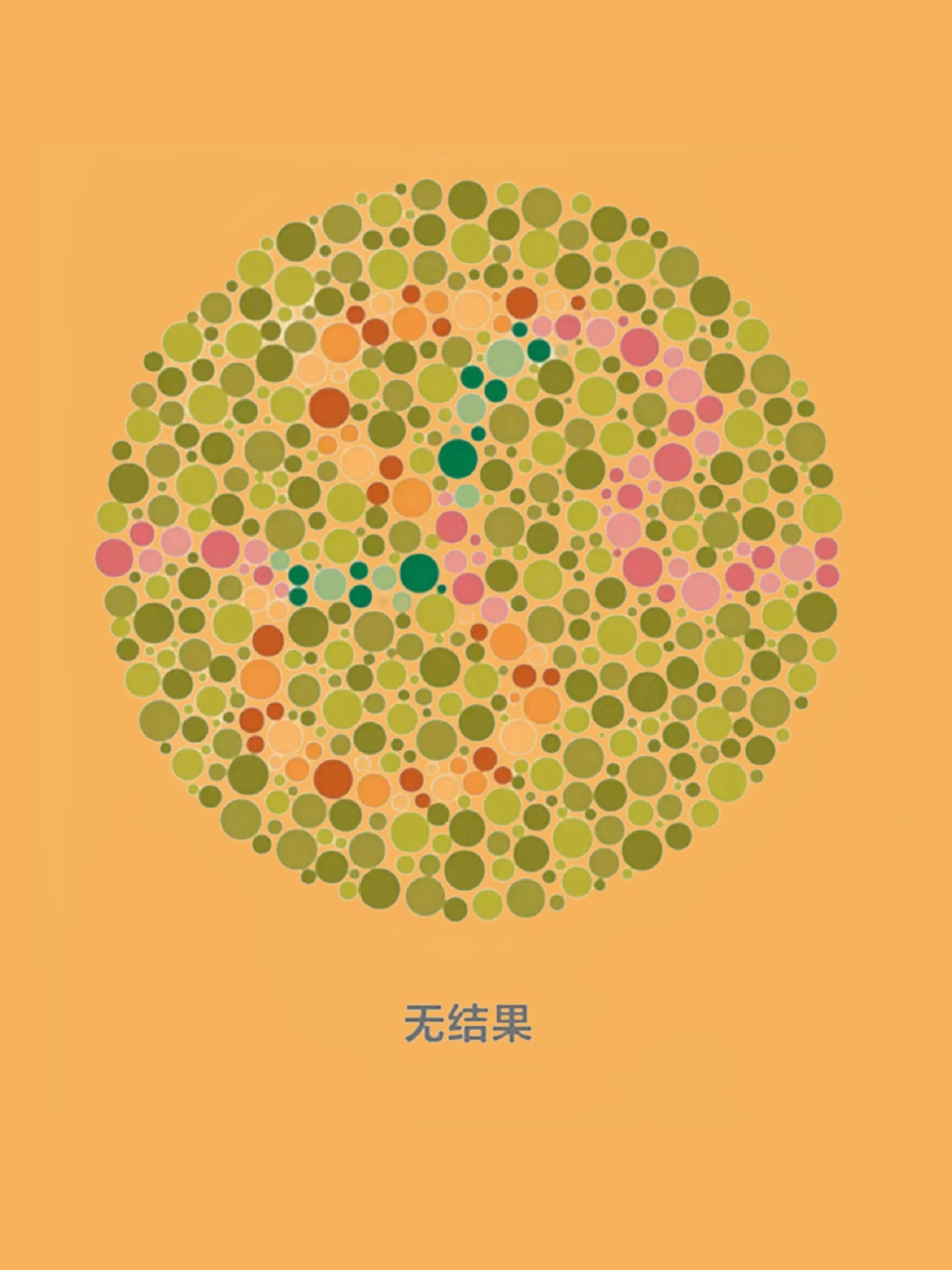 考驾照体检视力要求  朋友们,考驾照的视力标准大家一定要了解!