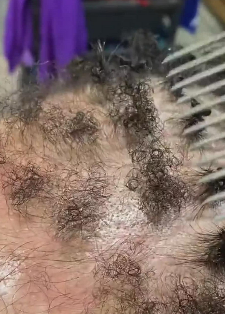 属于头发最后的倔强