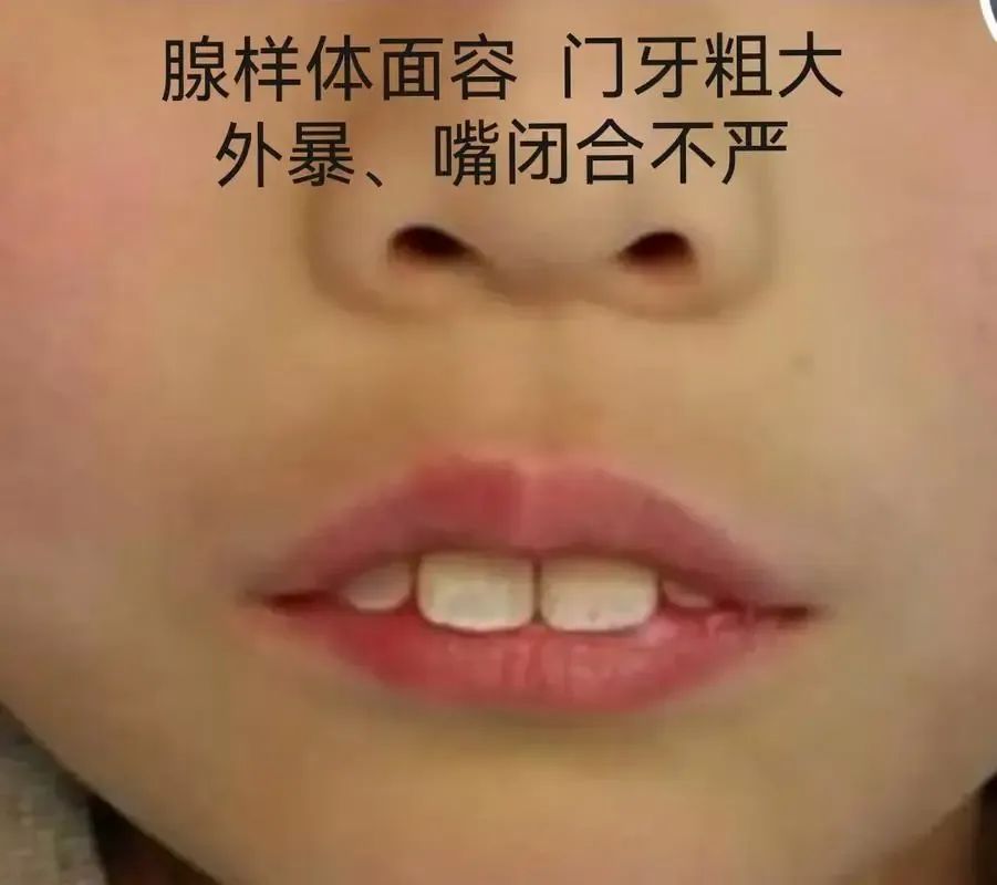 鼻炎和寒湿有关用这个方法对付鼻炎鼻子通气