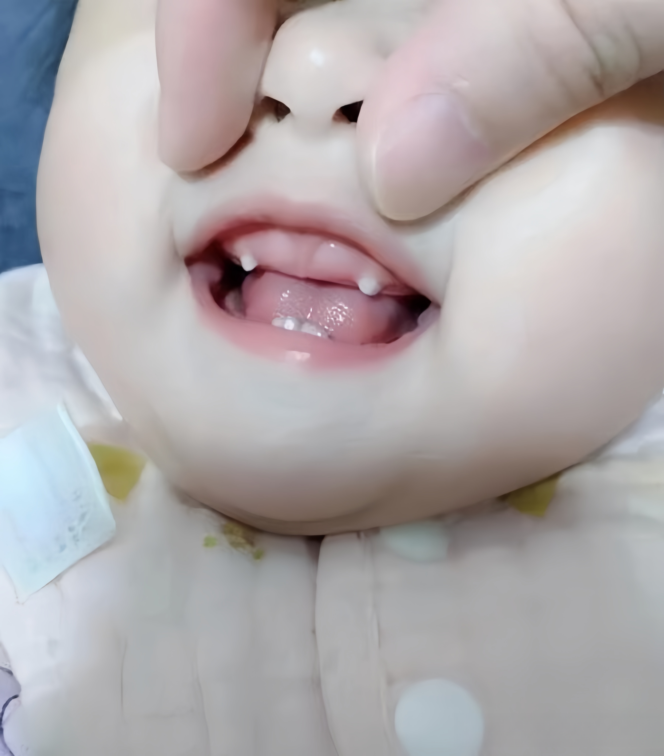 女人有虎牙也许会被视为美丽的象征,在当今社会,越来越欣赏这种独特之