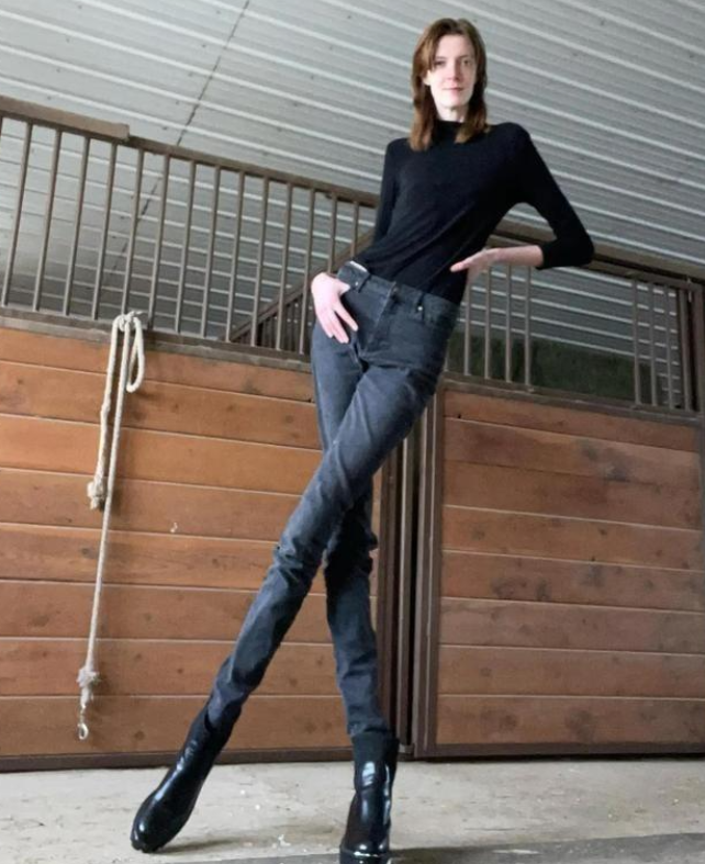 这个女人有着世界上最长的腿