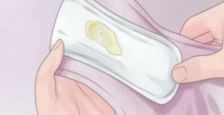 常见白带异常的情况及其可能的原因