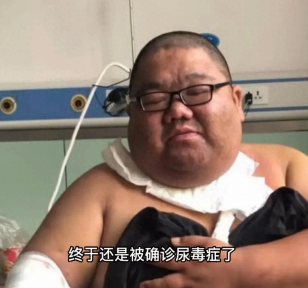 吃播四巨头现状2年没俩恩克直播吐血胖猴仔为保命减肥