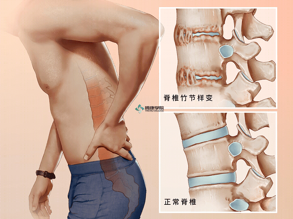 后背疼痛做什么检查图片