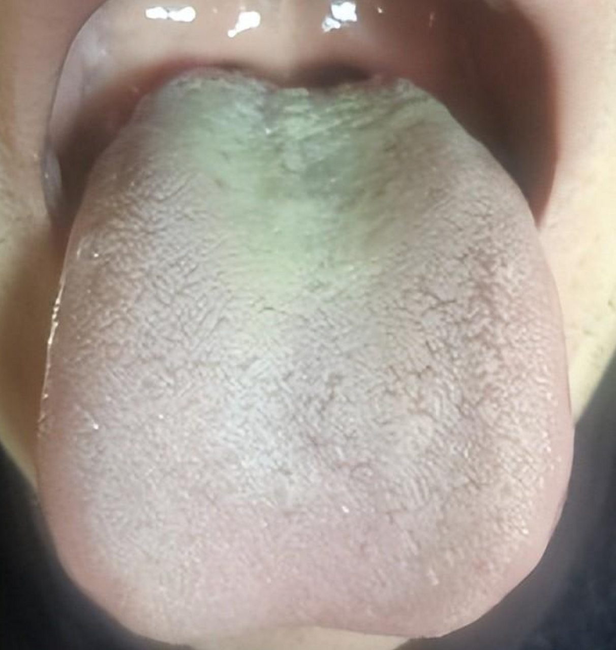 肾阴虚,肾阳虚还在傻傻分不清?