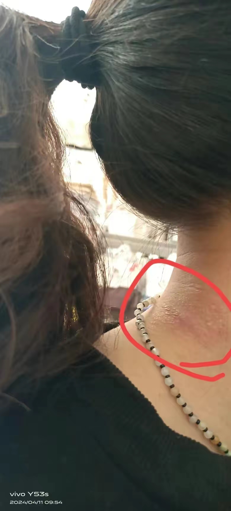 前几天出差的时候买了一条项链,自己挺喜欢的,戴了几天后,脖子奇痒无