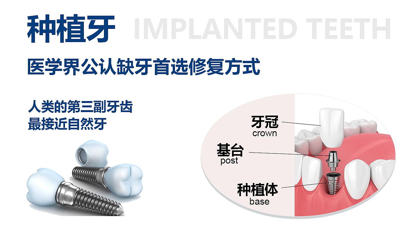 公立医院可以分期吗?种植牙能用多久?