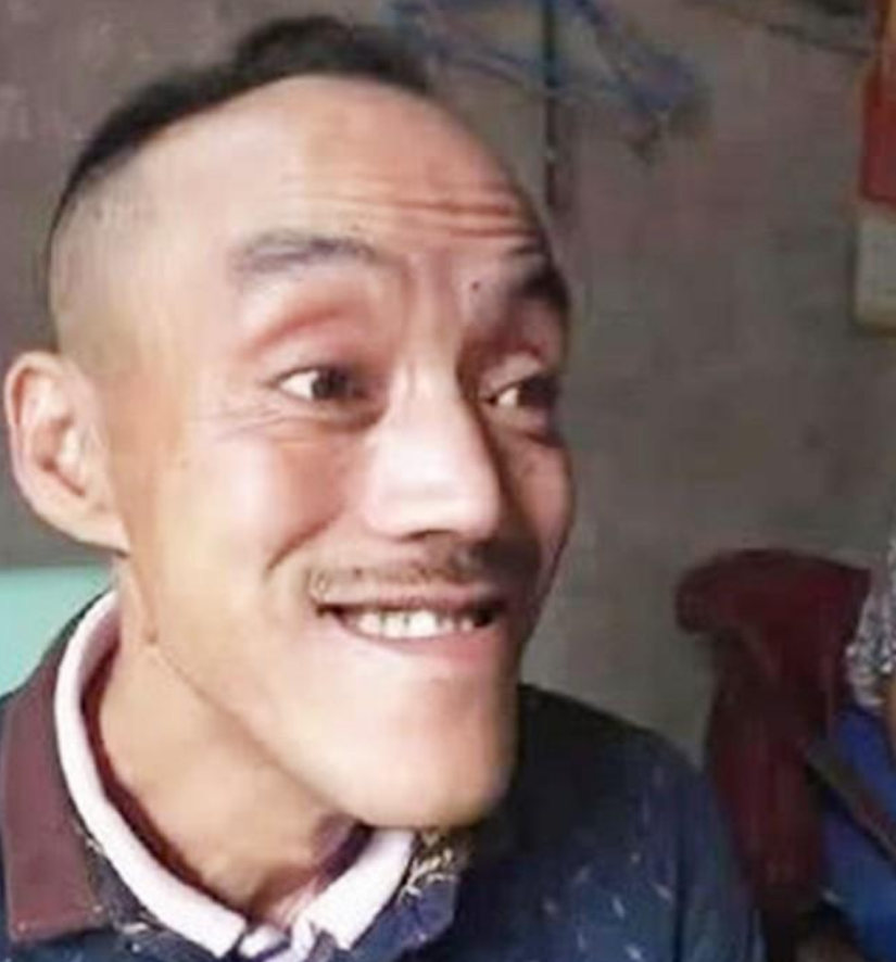 回顾靠"光头强"走红,娶网红开豪车,后媳妇跑路,开摩的讨生活