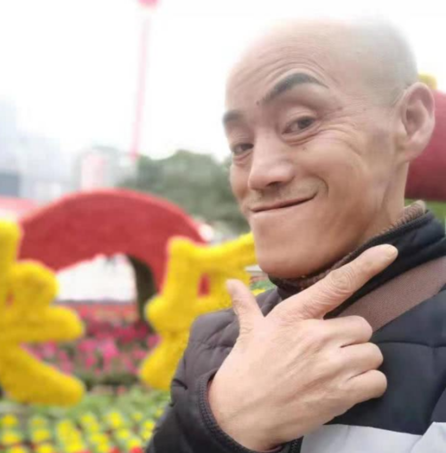 回顾靠"光头强"走红,娶网红开豪车,后媳妇跑路,开摩的讨生活