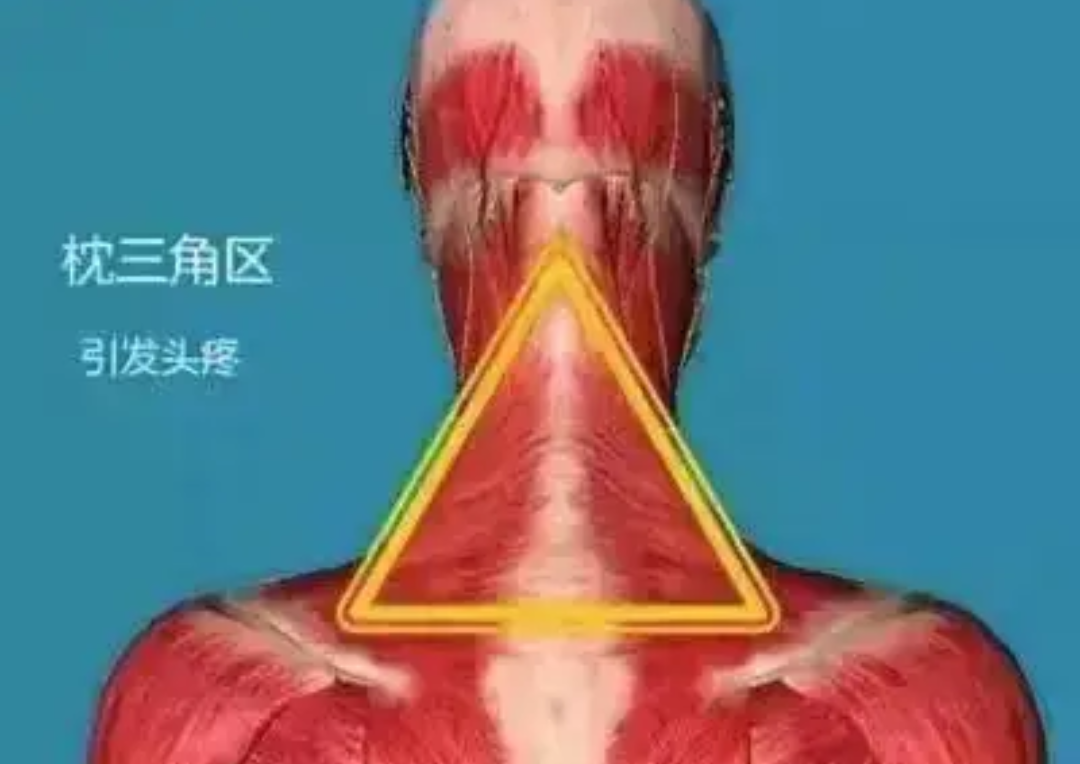 在我们的脖子后面有一个"金三角"区,它是人体的一个重要部位