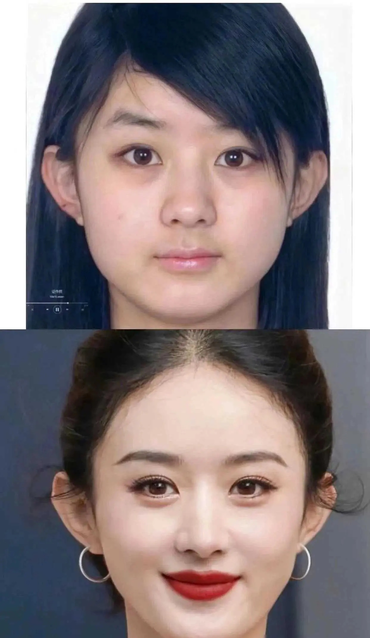 赵丽颖鼻子之谜网友猜测纷纷真相究竟如何?