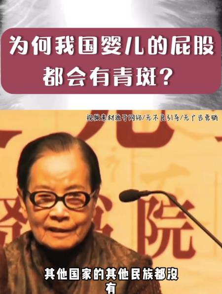 叶曼先生为何我国婴儿的屁股都会有青斑看完恍然大悟