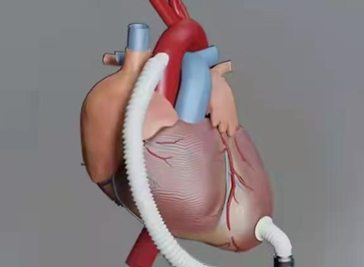 2000年东北老汉移植心脏后性情大变妻子像精力过剩的小伙子