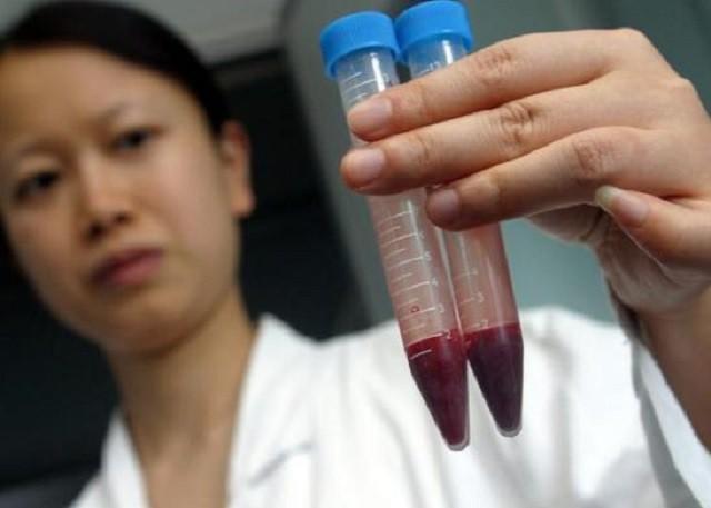 18年,福建一男子去做亲子鉴定,发现自家双胞胎有一个