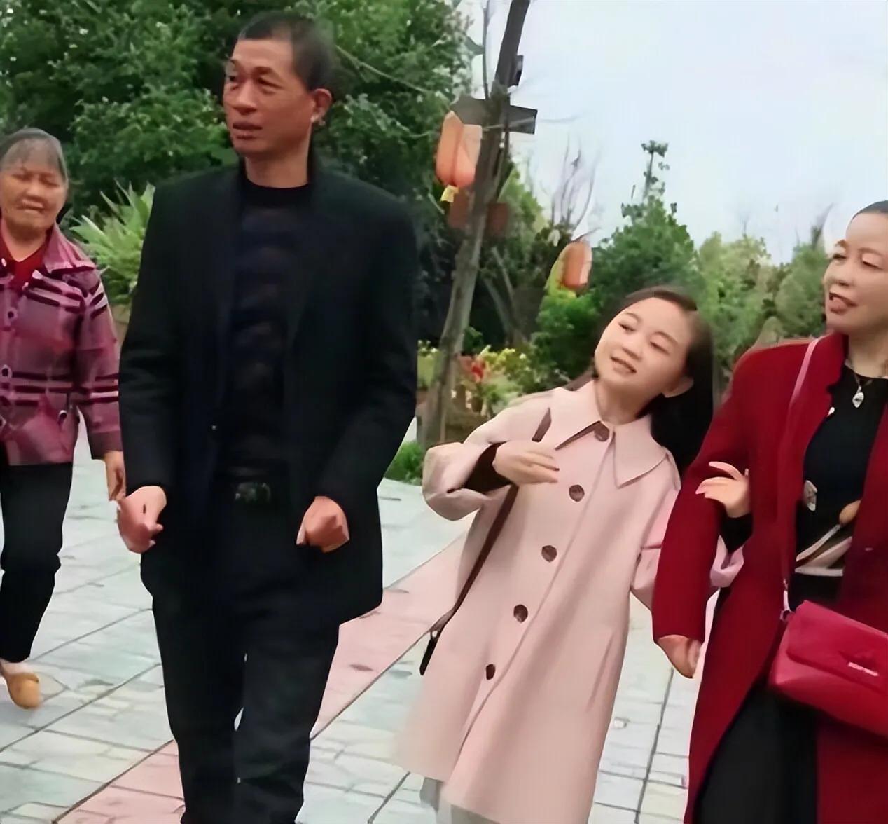 回顾四川袖珍美女32岁长得像10岁2019年嫁袖珍老公幸福至今