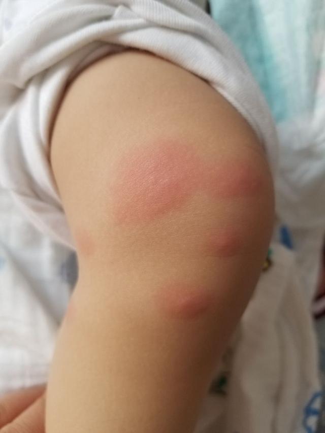 九成人不知道蚊子天敌是什么教你招开窗也不怕一夜安睡