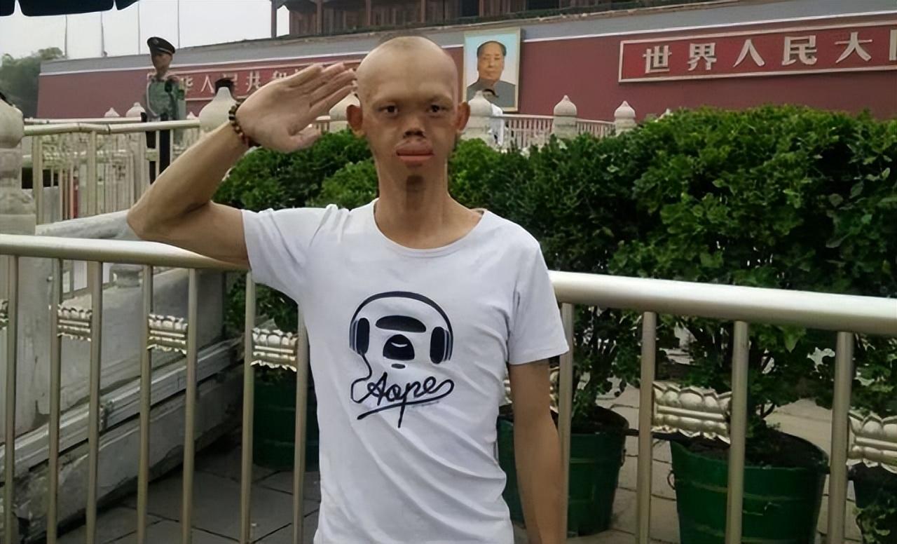 回顾特型演员的逆袭之路,靠怪异长相吸粉无数,还娶了美貌娇妻