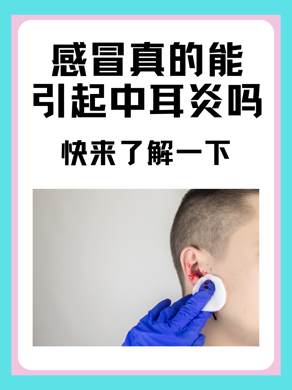 中耳炎吃阿莫西林有用吗百科在线