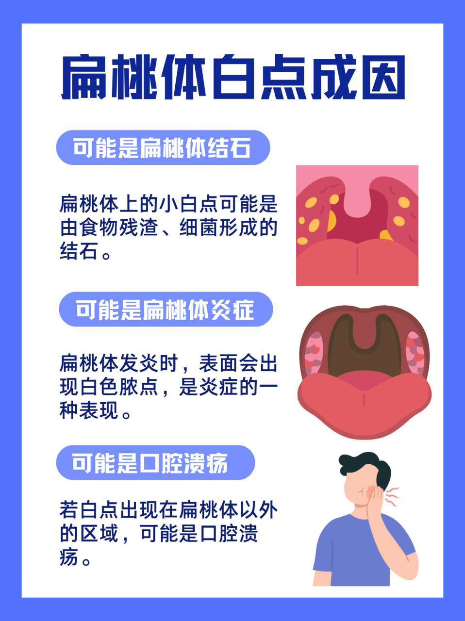 揭秘扁桃体的小白点 前几天有个病人来医院,一开口就说:"医生,我