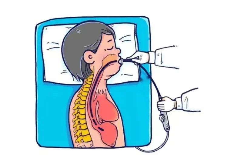 介入诊疗又有新突破:一把"小伞"完美封堵心脏小圆孔