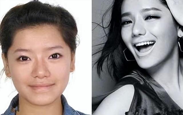 回顾超女冠军江映蓉:因整容失败像"怪物",全身只剩眼珠是自己的