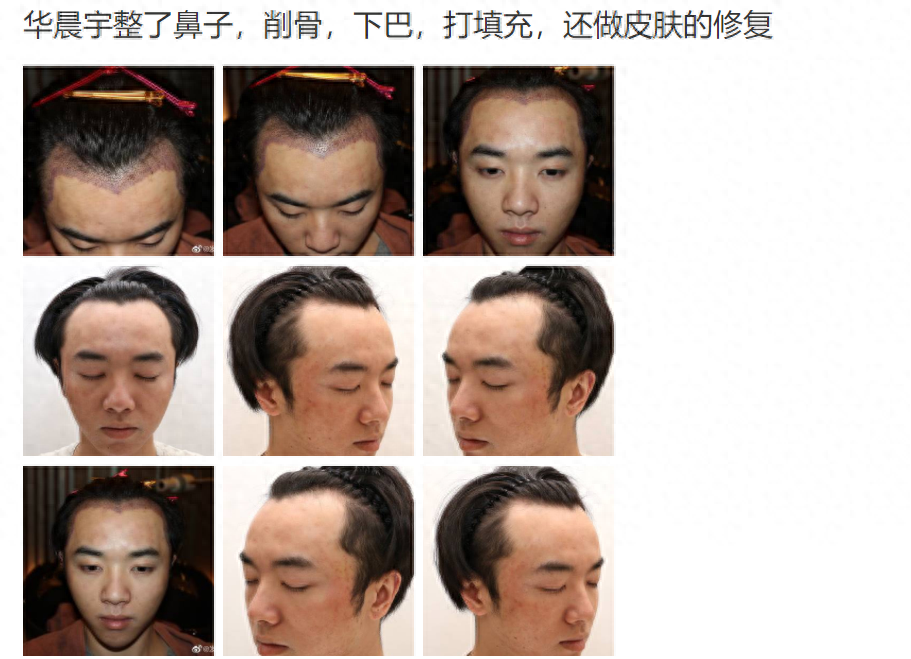 04华晨宇