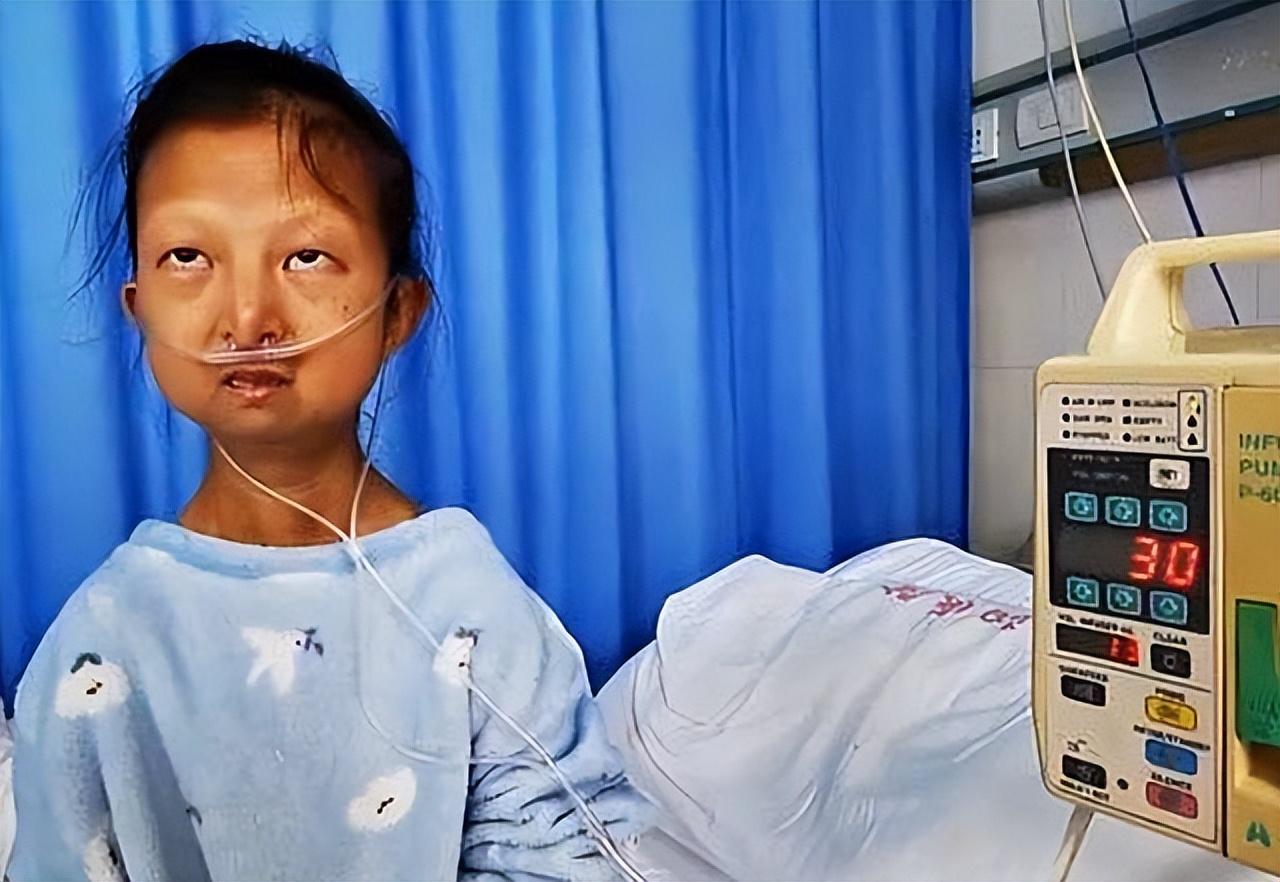 2020年43斤袖珍女孩病逝,遗体捐赠仪式上,弟弟:姐姐走得很安祥